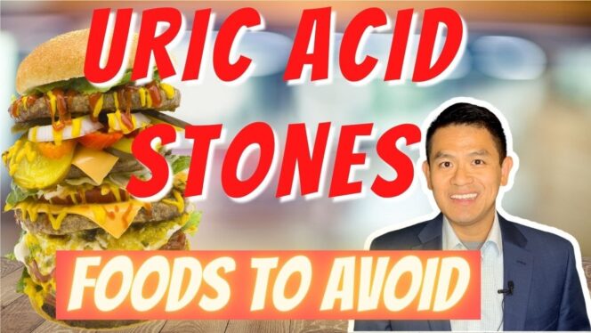 
					How to Prevent Uric Acid Kidney Stones: Your Complete Guide to Diet and Lifestyle